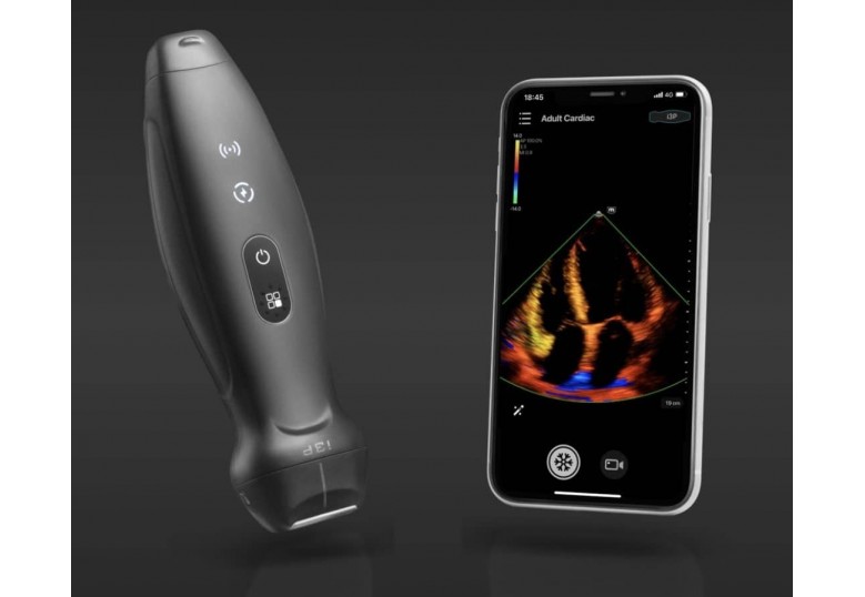 Mindray TE Air Portable Ultrasound